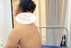 Sengketa Lahan Berujung Bacokan, Dua Karyawan Jadi Korban