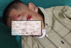 5 Remaja Kena Luka Tusukan dan Pukulan Botol AM, Kejadian Malam Hari di Kawasan Jembatan Benteng Lahat