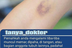 Ternyata Ini Faktor Yang Membuat Tubuh Memar Tanpa Sebab